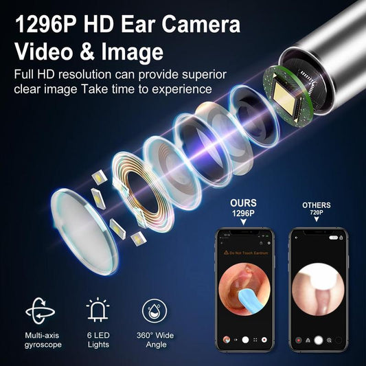 Earwax Removal Tool Set with Camera - Portable 360° Wide Angle Ear Cleaner with Type-C Rechargeable, Waterproof Ear Cleaning Tool for Iphone and Android Phones, Christmas Gift, Winter Gift Set, New Year Gift, Stocking Fillers Canal